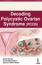 Decoding Polycystic Ovarian Syndrome