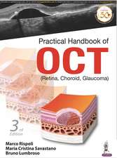 Practical Handbook of OCT: (Retina, Choroid, Glaucoma)