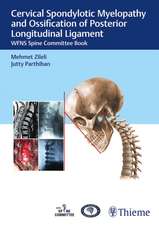 Cervical Spondylotic Myelopathy and Ossification – WFNS Spine Committee Book