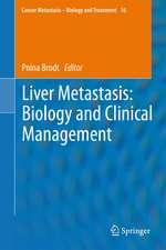 Liver Metastasis: Biology and Clinical Management