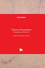 Venous Thrombosis