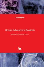 Recent Advances in Scoliosis