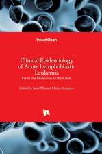 Clinical Epidemiology of Acute Lymphoblastic Leukemia