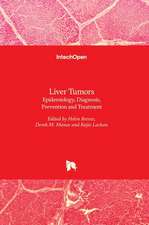 Liver Tumors