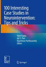 100 Interesting Case Studies in Neurointervention: Tips and Tricks