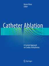 Catheter Ablation: A Current Approach on Cardiac Arrhythmias