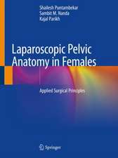 Laparoscopic Pelvic Anatomy in Females: Applied Surgical Principles