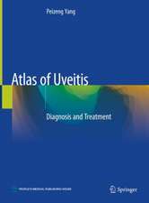 Atlas of Uveitis: Diagnosis and Treatment