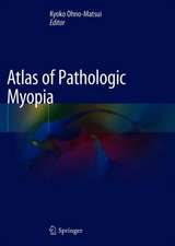 Atlas of Pathologic Myopia