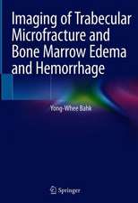 Imaging of Trabecular Microfracture and Bone Marrow Edema and Hemorrhage