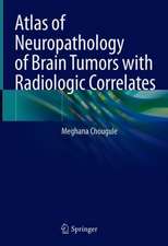 Neuropathology of Brain Tumors with Radiologic Correlates