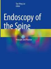 Endoscopy of the Spine: Principle and Practice