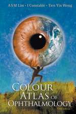 Colour Atlas of Ophthalmology