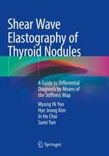 Shear Wave Elastography of Thyroid Nodules: A Guide to Differential Diagnosis by Means of the Stiffness Map