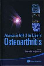 Advances in MRI of the Knee for Osteoarthritis