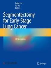 Segmentectomy for Early-Stage Lung Cancer: 3D Navigation