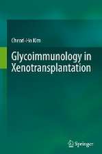 Glycoimmunology in Xenotransplantation