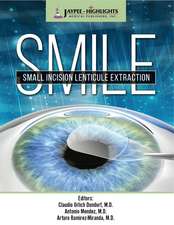 SMILE: Small Incision Lenticule Extraction