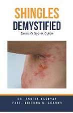 Shingles Demystified