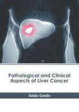 Pathological and Clinical Aspects of Liver Cancer